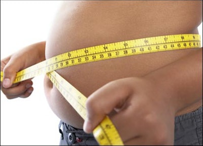 As Of 2010, 357 Percent Of Adults And 17 Percent Of Children Were Obese According To Disease Control And Prevention