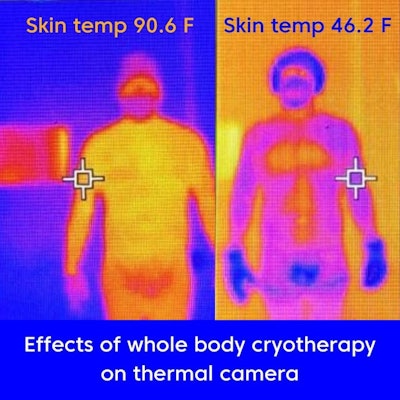 Cryo Built Skin Temp