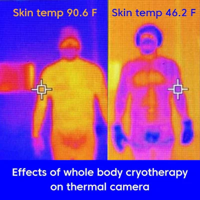 Cryo Built Skin Temp