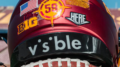 Visible X Minn 1
